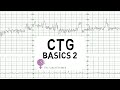 CTG Basics Part 2 - Decelerations & Fetal Physiology