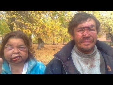 Как алкоголь влияет на внешность