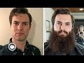 One Year Beard Growth Time-Lapse