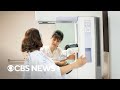 What to know about new breast cancer screening guidelines