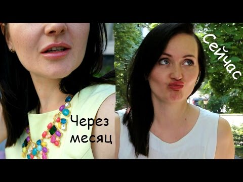 Как быстро рассасывается филлер в губах Как быстро рассасывается филлер в губах