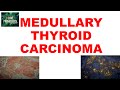 MEDULLARY THYROID CARCINOMA : Gross, Microscopic & Clinical features
