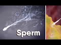 What Is Sperm?What is sperm made of? medical animation #sperm #fertilization