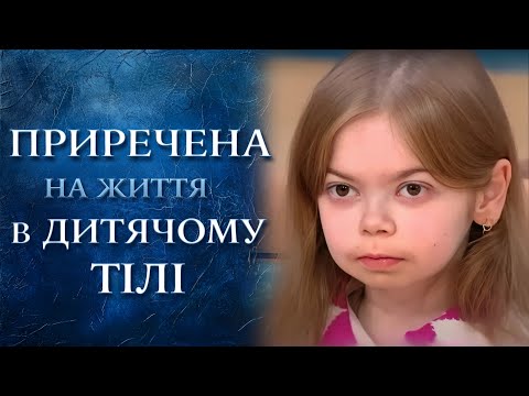 Все РукоТворчество: Пошаговый мастер-класс мимозы из бисера Болит десна