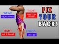 Fix "Anterior Pelvic Tilt" in 10 Minutes/Day (Daily Exercise Routine)