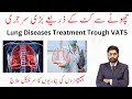 Lung Diseases Treatment Trough VATS | Dr. Ahmad Ali Thoracic Surgeon | Urdu/Hindi