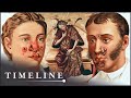 1495 Syphilis Outbreak: The Deadly Disease That Swept Across Europe | The Syphilis Enigma | Timeline