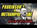 Hitler’s Tremors - Parkinson's Disease or Methamphetamine Use?