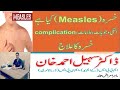 Measles | Khasra ka ilaj | Khasra ki Alamat | خسرہ کی علامات اور علاج | Measles Ka ilaj in Urdu