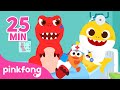 🦴 CRACK! My Bone is Broken + More | Baby Shark's Hospital Play Compilation | Pinkfong Story for Kids