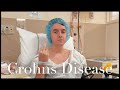 Living With Crohns Disease | My Experience After 4 Years