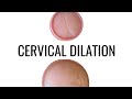 Cervical Dilation - up close!!