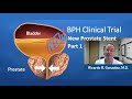New BPH treatment clinical trial Part 1: Prostate Stent
