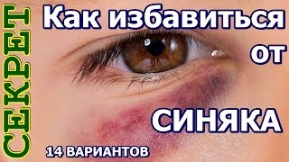 Чем вывести синяки под глазами в домашних условиях Чем вывести синяки под глазами в домашних условиях