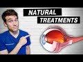 7 Natural Ways to Prevent & Treat Glaucoma + Q&A