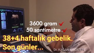 38+4 haftalık gebelik (Kliniğimizden görüntüler) - Dr. Kağan Kocatepe