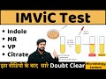IMViC Test ( Indole, MR, VP, Citrate Utilization Test ) IMViC Test Procedure in  Microbiology