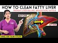 How to Cure Fatty Liver | கல்லீரலில்  கொழுப்பை சுத்தம் செய்வது எப்படி | Dr. Deepthi Jammi