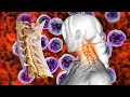 Cure Cervical Spondylosis, Cleanses Out All Negative Energy, Full Body Detox, Physical Healing
