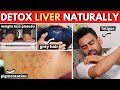 How to Cleanse Your Liver Naturally?