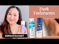 Lightening & Preventing DARK UNDERARMS | Dr. Jenny Liu