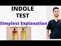 INDOLE TEST IN MICROBIOLOGY/ Bacterial Identification Test