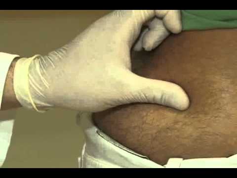 cramping after ovulation while on clomid cramping after ovulation while on clomid
