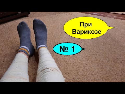 Варикоза лечение в домашних условиях Варикоза лечение в домашних условиях