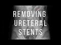 Removing Ureteral Stent in 15 Seconds #shorts