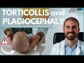 How to TREAT BABY TORTICOLLIS and PLAGIOCEPHALY - Dr. Matteo Silva, Pediatric Osteopath