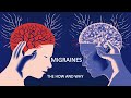 The Science Behind Migraines:  Scientific Animations Explains the hows and whys of migraines.
