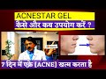 Acnestar cream-कब और कैसे लगाना चाहिए | AcneStar Gel Review |Acnestar gel- Price- Uses & Side Effect