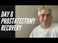 6 Days Post Prostate Cancer Surgery - Prostatectomy Recovery Feb 2021