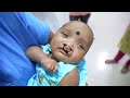 Rare Cleft Baby going under Anesthesia