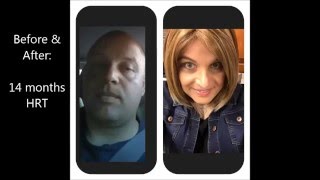 male to female transition