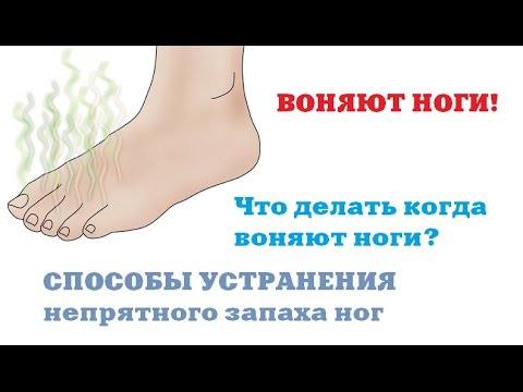 Воняют ноги в кроссовках что делать