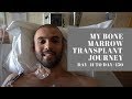 My Bone Marrow Transplant Journey | Day -11 to Day +150 | Vlog | Leukaemia |AML | Cancer |