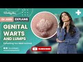 DOCTOR explains - Everything You Need to Know About Genital Warts and Other Lumps