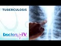 TUBERCULOSIS: Symptoms and Treatment | DOTV