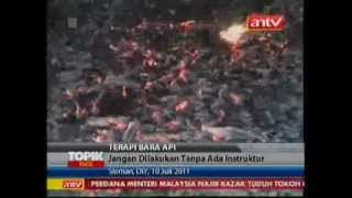 Terapi Pengobatan dengan Bara Api (Fireball Therapy)
