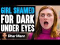 GIRL SHAMED For DARK UNDER EYES Ft. Christen Dominique | Dhar Mann