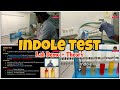 Indole Test | Lab demo | Tamil | Biochemistry | ThiNK Biology