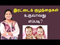 How Twins are formed? | Tamil