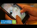 Ano ang neonatal acne sa mga sanggol at paano ito maiiwasan? | Pinoy MD