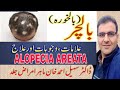 Alopecia Areata | Baal Khora ka ilaj | Bal Jhar ka ilaj in Urdu | Balchar ka ilaj | Baal Girna