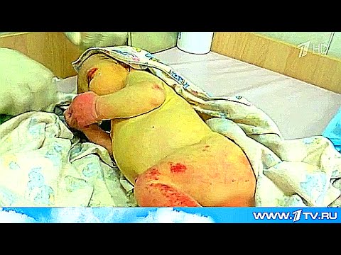 Введение геля для стимуляции родов Метки: сколько, действовать Боли в области сердца при различных заболеваниях - причины