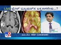 Nimma Doctor | Treatment For Brain Tumor | Aster RV Hospital