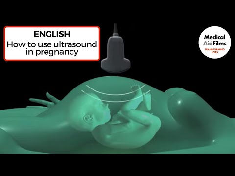 Determining sex at 20 week scan