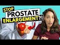 Best Ways to Prevent Prostate Enlargement, Explained by a Urologist