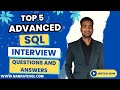 Top 5 Advanced SQL Interview Questions and Answers | Frequently Asked SQL interview questions